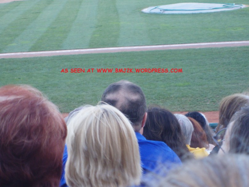 WORLD'S WORST BALDNESS